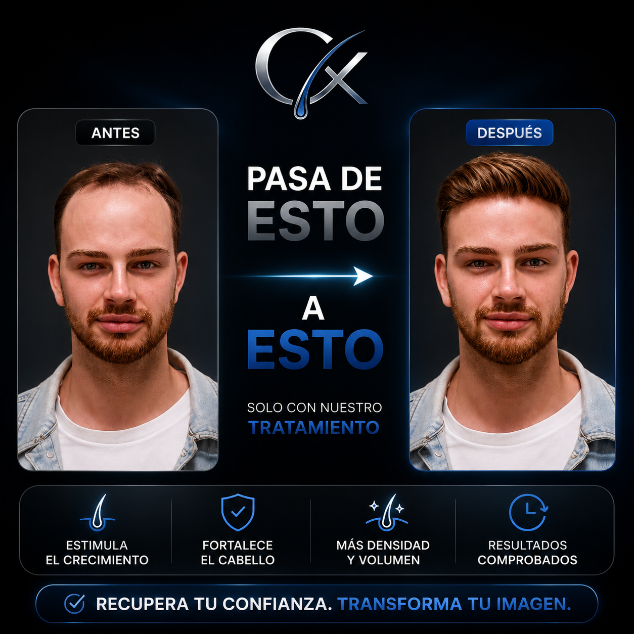 Capilix Experience™ — Tratamiento Personalizado Anticaída