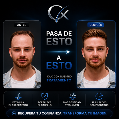 Capilix Experience™ — Tratamiento Personalizado Anticaída